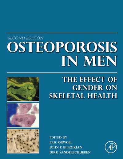 Osteoporosis in men